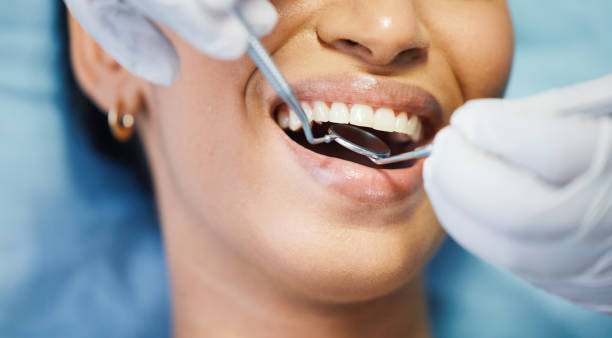Best Teeth Whitening  in Barre, VT