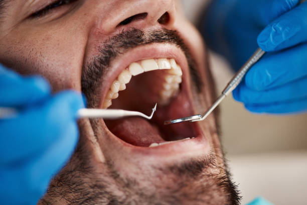 Best Cracked Tooth Emergency Dentist  in Barre, VT